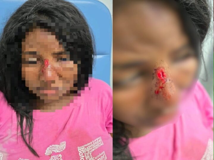 Polícia prende homem que espancou mulher com chutes na cabeça e rosto em Campo Alegre